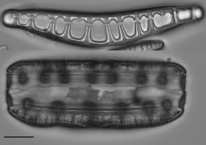 Epithemia Alpestris  Ill2017 07