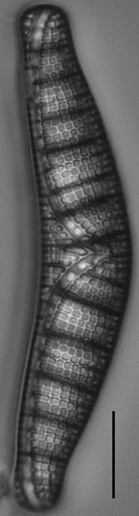 Epithemia Alpestris  L 5 71 05