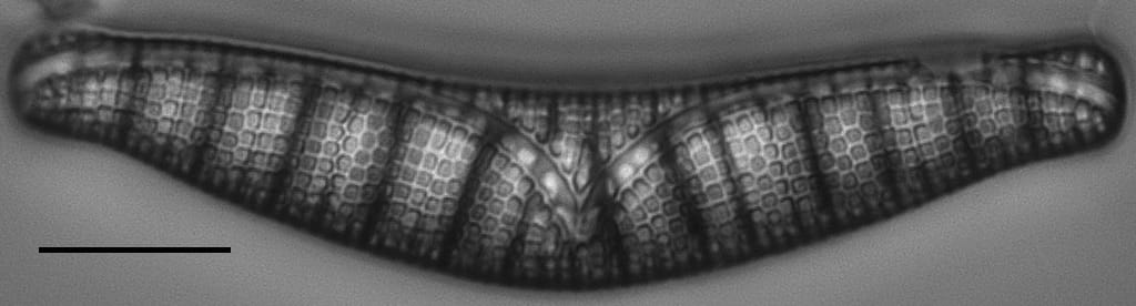 Epithemia Alpestris  L 5 71 05