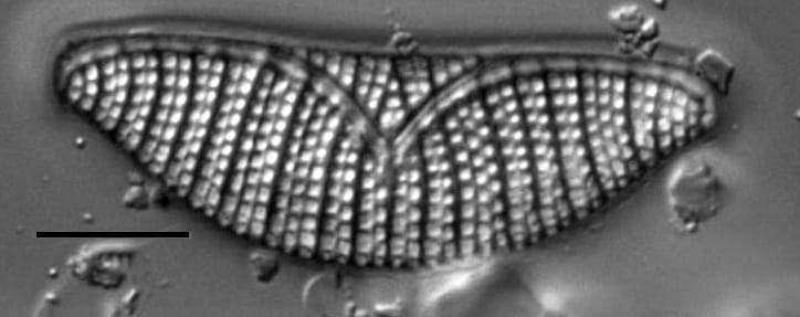 Epithemia turgida LM6