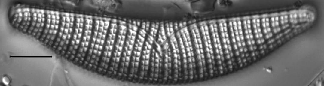 Epithemia turgida LM1