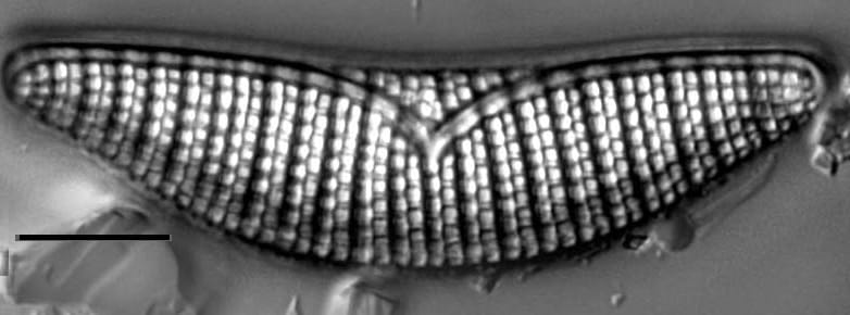 Epithemia turgida LM2