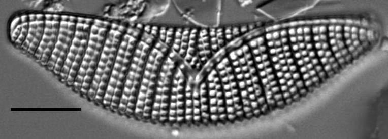 Epithemia turgida LM3