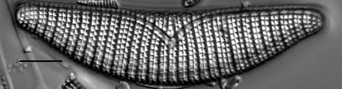 Epithemia turgida LM4