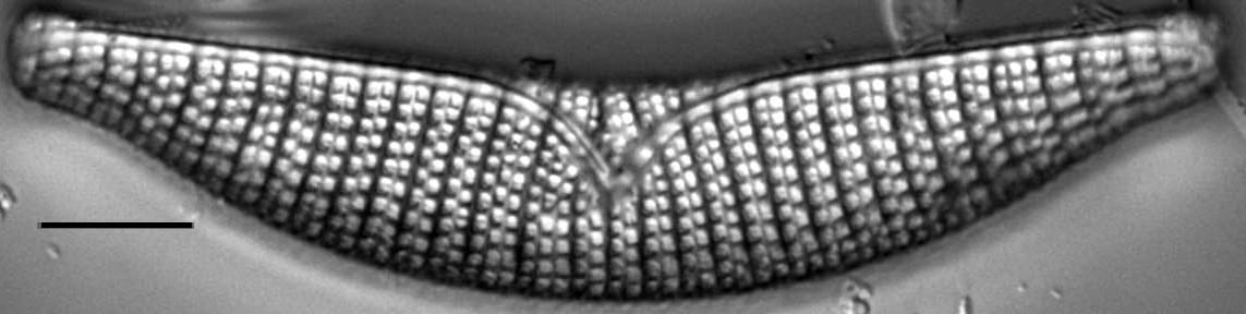 Epithemia turgida LM5