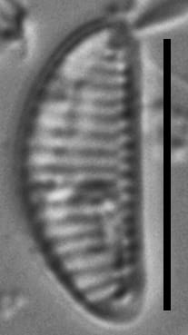 Eunotia boreotenuis LM2 GC8124 B 079
