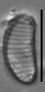 Eunotia boreotenuis LM6 GC8124 B 104