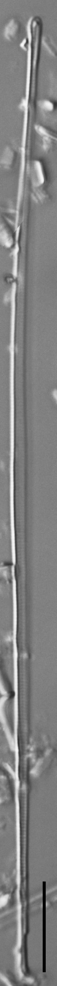 Eunotia romanowii ANSP Siver Egg Harbor0 1 01