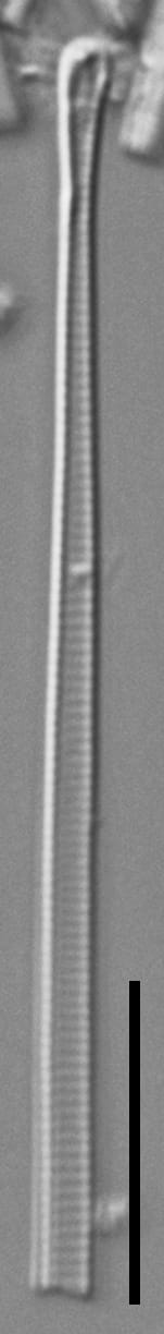 Eunotia romanowii ANSP Siver Egg Harbor0 1 03