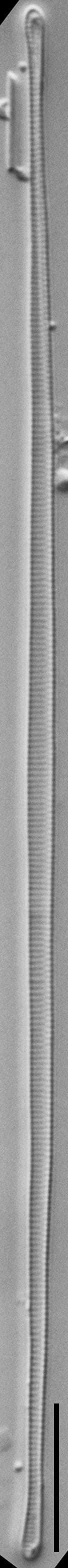 Eunotia romanowii ANSP Siver Egg Harbor0 1 04