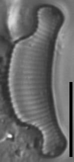 Eunotia septentrionalis LM2 GC8151 A 003