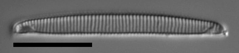 Eunotia 139 080B A 1600X Ps