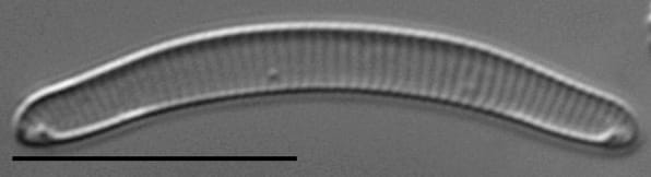 Eunotia 155 080B A  Ss