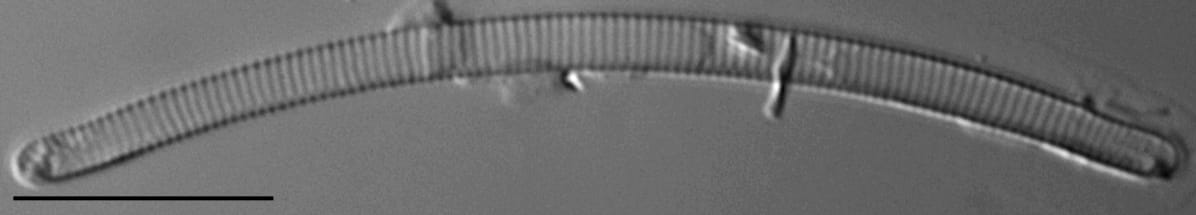 Eunotia 170 078A A  Ss