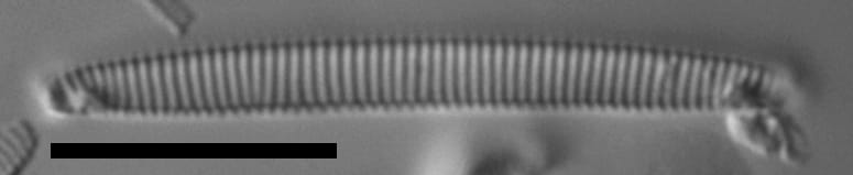 Eunotia 18 107A A 1600X Ps