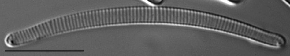 Eunotia 63 076B C  Ss