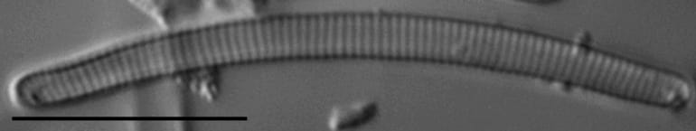 Eunotia 99 081B B  Ss