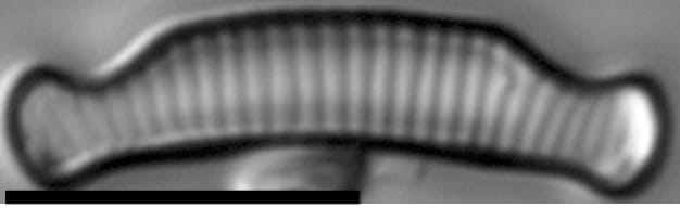 Eunotia cataractarum LM1