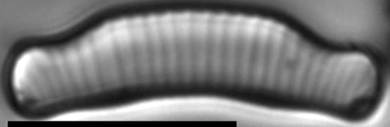 Eunotia cataractarum LM3