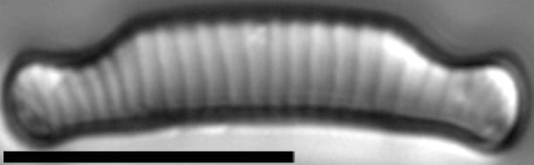 Eunotia cataractarum LM4