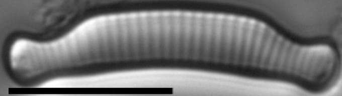 Eunotia cataractarum LM5