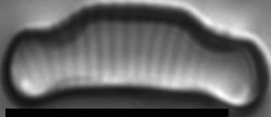 Eunotia cataractarum LM7