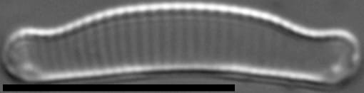 Eunotia enischna LM1