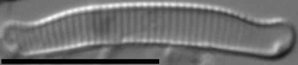 Eunotia enischna LM3