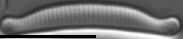 Eunotia enischna LM5