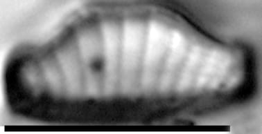 Eunotia kociolekii LM5