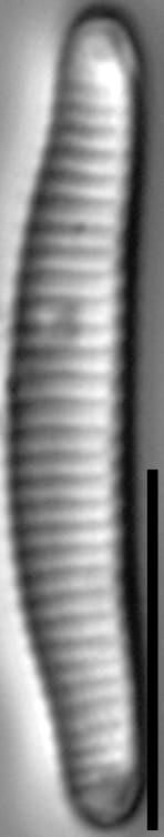 Eunotia mydohaimasiae LM3