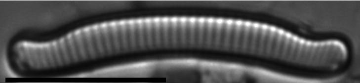 Eunotia nymanniana LM2