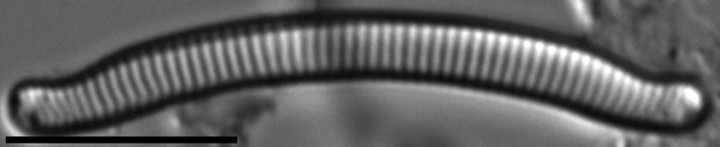 Eunotia nymanniana LM5