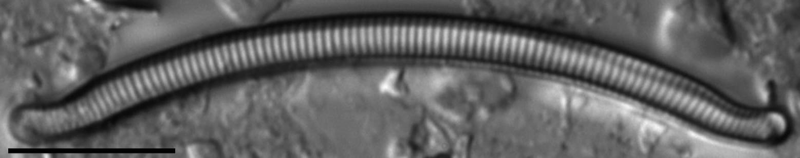 Eunotia nymanniana LM7