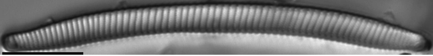 Eunotia obliquestriata LM3