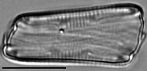 Eunotia rhomboidea LM7