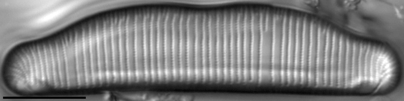 Eunotia richbuttensis LM2