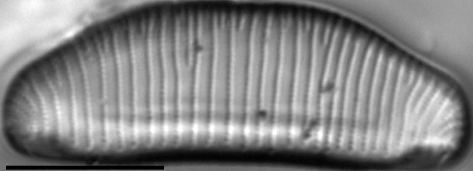 Eunotia richbuttensis LM5