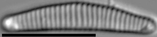 Eunotia rushforthii LM1