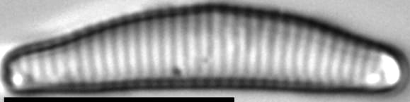 Eunotia rushforthii LM5