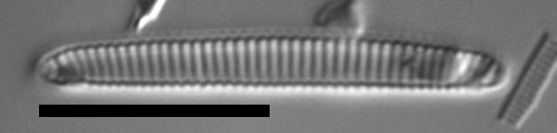 Eunotia Sp30Um 1 068B A 1600X Ps