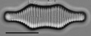 Fragilaria constricta LM1