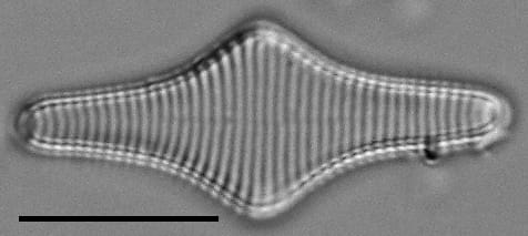 Fragilariforma polygonata LM5