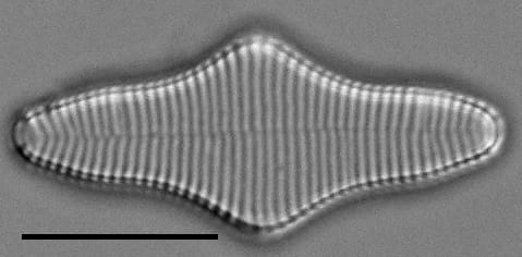 Fragilariforma polygonata LM1