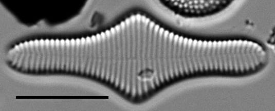 Fragilariforma polygonata LM2