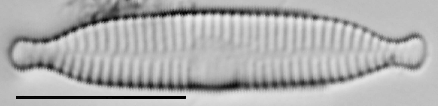 Fragilaria recapitellata LM2