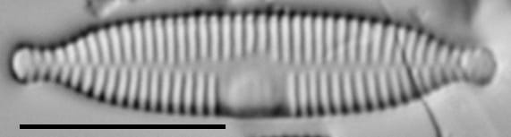 Fragilaria recapitellata LM5