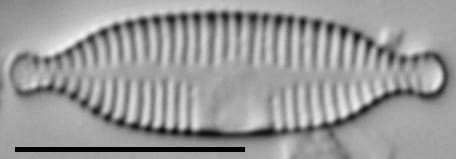 Fragilaria recapitellata LM4