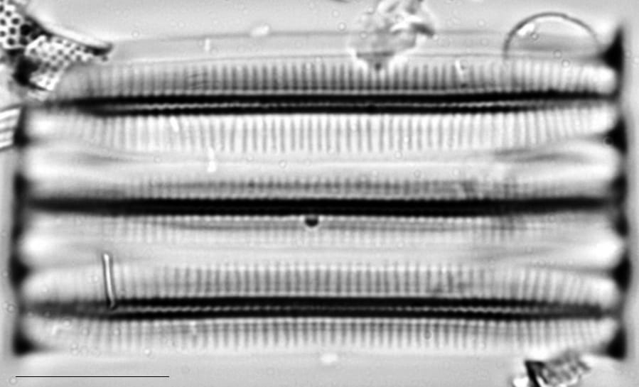 Fragilariforma virescens LM1