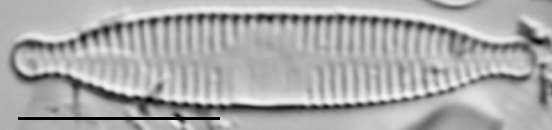 Fragilaria recapitellata LM6